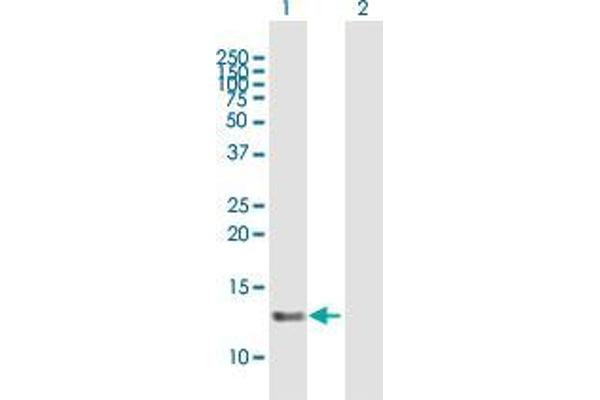 SNRNP25 anticorps  (AA 1-132)