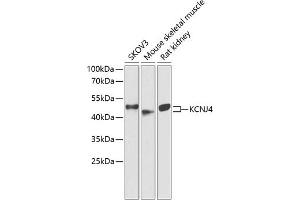 Western blot analysis of extracts of various cell lines, using KCNJ4 antibody (ABIN6134096, ABIN6142734, ABIN6142737 and ABIN6218214) at 1:1000 dilution.