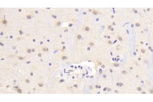 Detection of TREM2 in Rat Cerebrum Tissue using Polyclonal Antibody to Triggering Receptor Expressed On Myeloid Cells 2 (TREM2) (TREM2 anticorps  (AA 1-228))