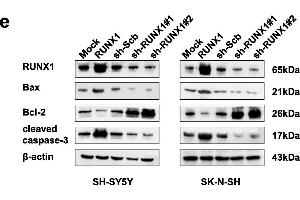 Overexpression of RUNX1 promoted NB cell apoptosis, and knockdown of RUNX1 led to suppression of NB apoptosis.
