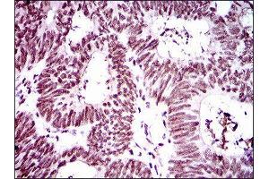 Immunohistochemistry (IHC) image for anti-Ring Finger Protein 1 (RING1) (AA 79-263) antibody (ABIN1845880) (RING1 anticorps  (AA 79-263))