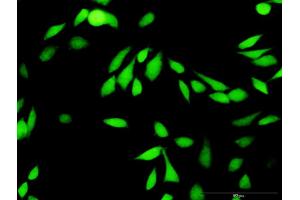 Immunofluorescence of purified MaxPab antibody to XIAP on HeLa cell.
