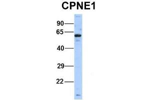 Host:  Rabbit  Target Name:  CPNE1  Sample Type:  Human Hela  Antibody Dilution:  1. (CPNE1 anticorps  (Middle Region))