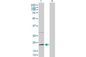 Western Blot analysis of TAF8 expression in transfected 293T cell line by TAF8 MaxPab polyclonal antibody. (TAF8 anticorps  (AA 1-174))