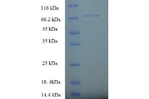 SDS-PAGE (SDS) image for serine Palmitoyltransferase, Long Chain Base Subunit 2 (SPTLC2) (AA 88-562), (partial) protein (His-SUMO Tag) (ABIN5710414)