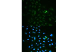 Immunofluorescence analysis of MCF7 cell using CD79B antibody. (CD79b anticorps  (AA 29-159))