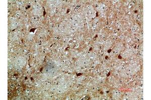 Immunohistochemical analysis of paraffin-embedded human-brain, antibody was diluted at 1:200