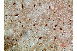 Immunohistochemical analysis of paraffin-embedded human-brain, antibody was diluted at 1:200 (NFAT5 anticorps  (AA 1268-1341))