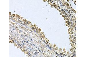 Immunohistochemistry of paraffin-embedded Human prostate using MEMO1 Polyclonal Antibody at dilution of 1:100 (40x lens). (MEMO1 anticorps)