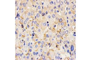 Immunohistochemistry (IHC) image for anti-Chitinase 3-Like 1 (Cartilage Glycoprotein-39) (CHI3L1) (AA 22-240) antibody (ABIN1679215) (CHI3L1 anticorps  (AA 22-240))