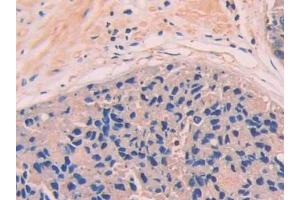 Used in DAB staining on fromalin fixed paraffin- embedded kidney tissue (Complement Factor B anticorps  (AA 35-160))