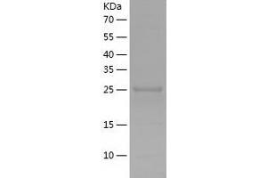 Western Blotting (WB) image for Transforming Growth Factor, beta Receptor Associated Protein 1 (TGFBRAP1) (AA 601-860) protein (His tag) (ABIN7125459)
