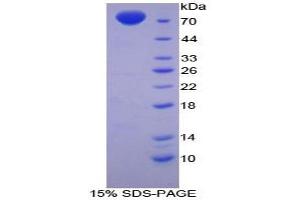 SDS-PAGE analysis of Chicken MSE Protein. (MSE Protéine)