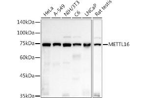 Western blot analysis of extracts of various cell lines, using METTL16 antibody (ABIN7268501) at 1:1000 dilution. (METTL16 anticorps  (AA 263-562))