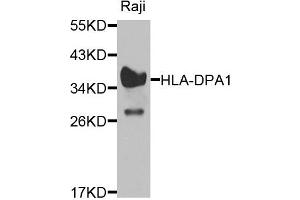 Western blot analysis of extracts of raji cells, using HLA-DPA1 antibody. (HLA-DPA1 anticorps)