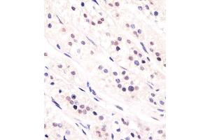 Antibody staining CDC73 in human adrenal gland tissue sections by Immunohistochemistry (IHC-P - paraformaldehyde-fixed, paraffin-embedded sections). (HRPT2 anticorps  (AA 132-161))