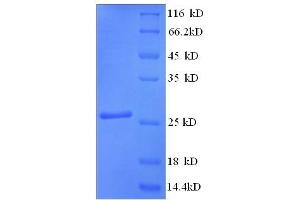 SDS-PAGE (SDS) image for Myosin Binding Protein C, Cardiac (MYBPC3) (AA 645-864), (partial) protein (His tag) (ABIN5713684) (MYBPC3 Protein (AA 645-864, partial) (His tag))