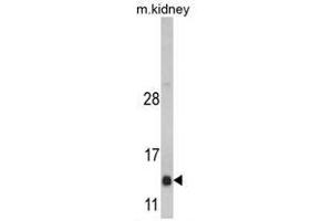 Image no. 1 for anti-DnaJ (Hsp40) Homolog, Subfamily C, Member 19 (DNAJC19) (Middle Region) antibody (ABIN452917) (DNAJC19 anticorps  (Middle Region))