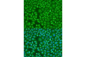 anti-Lethal Giant Larvae Homolog 2 (LLGL2) (AA 620-819) antibody