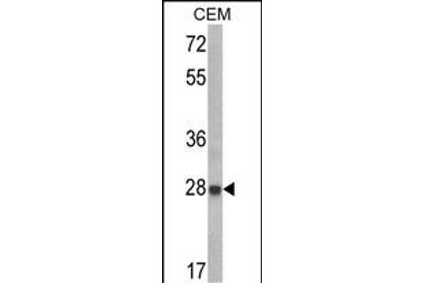 IGFBP6 Antikörper  (C-Term)