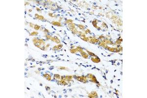 Immunohistochemistry of paraffin-embedded human stomach using OGN antibody at dilution of 1:100 (40x lens). (OGN anticorps)