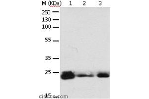 Western blot analysis of 293T cell and mouse brain tissue, A549, Hela, A172 and HT-29 cell, using RAB6A Polyclonal Antibody at dilution of 1:650 (RAB6A anticorps)