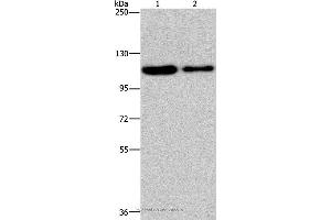 Western blot analysis of Hela and A172 cell, using PDE4A Polyclonal Antibody at dilution of 1:300 (PDE4A anticorps)