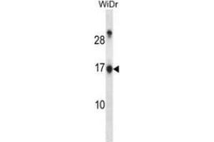 Western blot analysis in WiDr cell line lysates (35ug/lane) using NDP kinase A Antibody . (NME1 anticorps  (Middle Region))