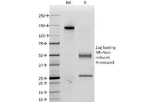 SDS-PAGE Analysis Purified CD34 Monoclonal Antibody (ICO-115). (CD34 anticorps)