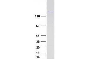 Validation with Western Blot