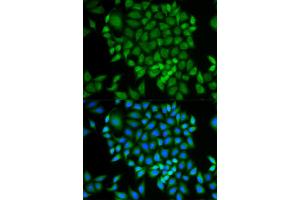Immunofluorescence analysis of MCF-7 cells using GLRX antibody. (Glutaredoxin 1 anticorps)