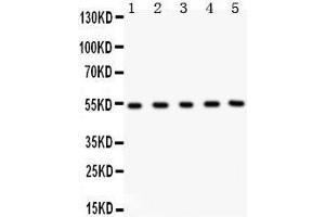 Anti- MMP3 Picoband antibody, Western blotting All lanes: Anti MMP3  at 0. (MMP3 anticorps  (C-Term))