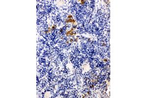 anti-Leupaxin (LPXN) (AA 115-129), (N-Term) antibody