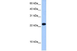 EIF4E3 anticorps  (Middle Region)