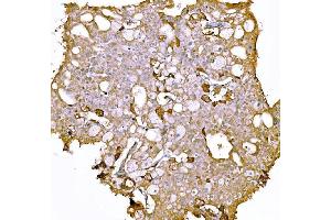 IHC analysis of Prothrombin using anti-Prothrombin antibody (ABIN7602705). (Prothrombin Fragment 2 (AA 97-124) anticorps)