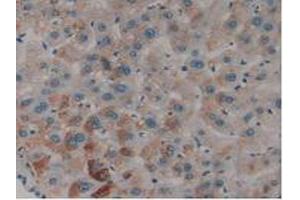 IHC-P analysis of Human Liver Tissue, with DAB staining. (PLAT anticorps  (AA 36-126))