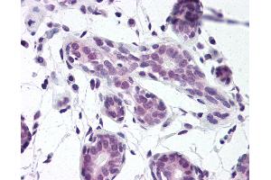 Anti-HuR antibody IHC of human breast. (ELAVL1 anticorps  (AA 1-13))