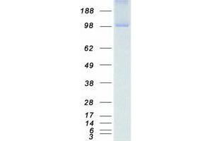Validation with Western Blot