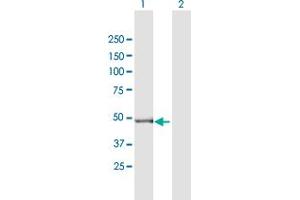 Western Blot analysis of GPT2 expression in transfected 293T cell line by GPT2 MaxPab polyclonal antibody. (GPT2 anticorps  (AA 1-523))