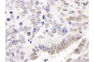 Immunohistochemistry (IHC) image for anti-GATA Zinc Finger Domain Containing 2A (GATAD2A) (AA 573-633) antibody (ABIN7448708) (GATAD2A anticorps  (AA 573-633))