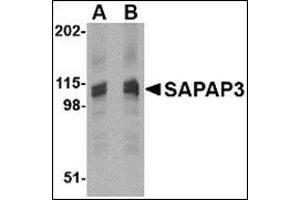 Western blot analysis of SAPAP3 in rat brain tissue lysate with this product at (A) 1 (B) 2 μg/ml. (DLGAP3 anticorps  (C-Term))