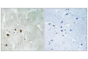 Immunohistochemistry analysis of paraffin-embedded human brain tissue using Tip60 (Phospho-Ser90) antibody. (KAT5 anticorps  (pSer90))