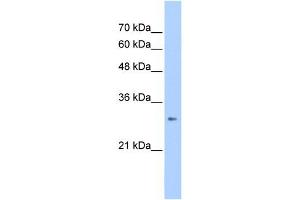 WB Suggested Anti-ING1 Antibody Titration:  2. (ING1 anticorps  (C-Term))