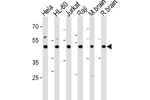 Western blot analysis in Hela,HL-60,Jurkat,Raji cell line and mouse brain,rat brain tissue lysates (35ug/lane).