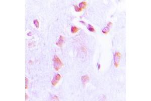 Immunohistochemical analysis of BCL2 (pT69) staining in human brain formalin fixed paraffin embedded tissue section. (Bcl-2 anticorps  (pSer69))