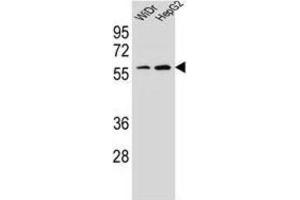 Western Blotting (WB) image for anti-Homeobox A10 (HOXA10) antibody (ABIN2995594) (HOXA10 anticorps)