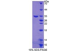 SDS-PAGE (SDS) image for Guanylate Binding Protein 3 (GBP3) (AA 29-271) protein (His tag) (ABIN6239552)