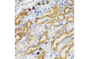 Immunohistochemistry of paraffin-embedded rat kidney using PGRMC1 antibody.