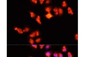 Immunofluorescence analysis of HeLa cells using HOXA11 Polyclonal Antibody at dilution of 1:100 (40x lens). (Homeobox A11 anticorps)