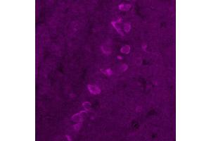 Immunohistochemistry (IHC) image for anti-Corticotropin Releasing Hormone (CRH) antibody (ABIN7456207)